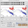Audio Restoration - DeNoise 2.8.4 Win/MacOSX (Team P2P) Audio Restoration - DeNoise 2.8.4 Win/MacOSX (Team P2P)