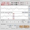 Audio Restoration - Clickrepair 3.9.8 Win/MacOSX (Team P2P) Audio Restoration - Clickrepair 3.9.8 Win/MacOSX (Team P2P)