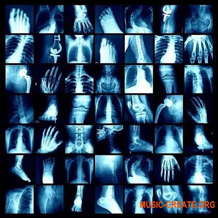 Xeromadeit [200+] "Genesis" (Serum 2 Presets)